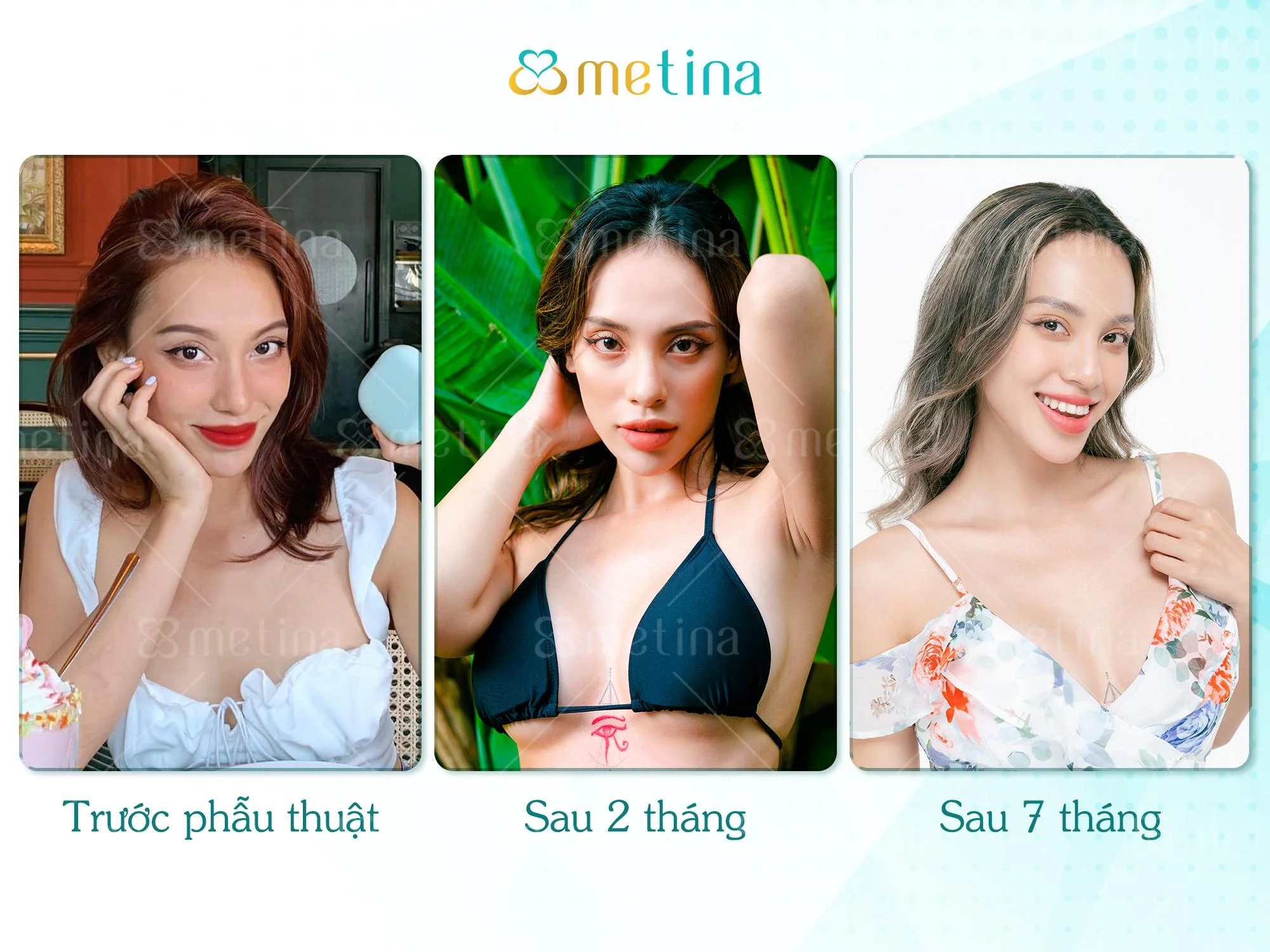 Diễn viên Quỳnh Laze sở hữu vòng ngực đẹp phù hợp với tỷ lệ cơ thể