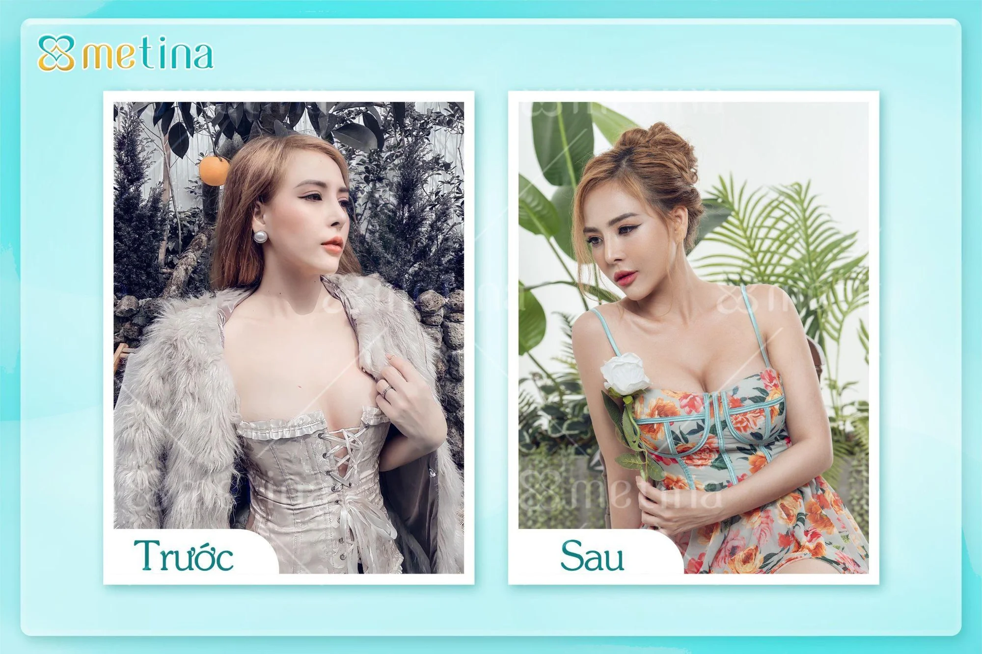 7 DÁNG NGỰC PHỔ BIẾN NHẤT - Dr. Châu Thanh Phong - Thẩm mỹ 3 vòng