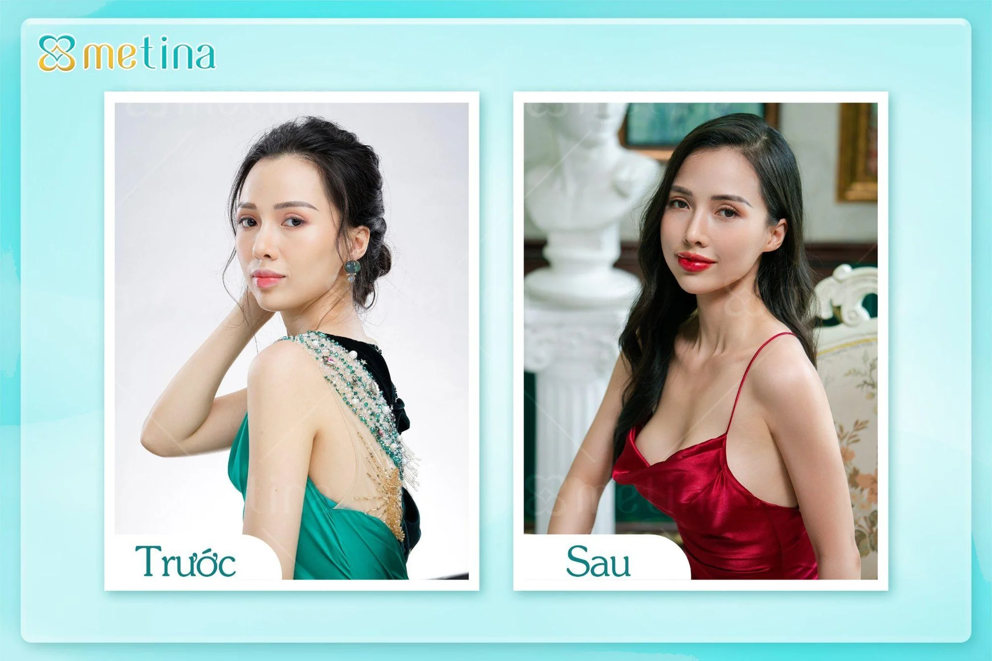 7 DÁNG NGỰC PHỔ BIẾN NHẤT - Dr. Châu Thanh Phong - Thẩm mỹ 3 vòng