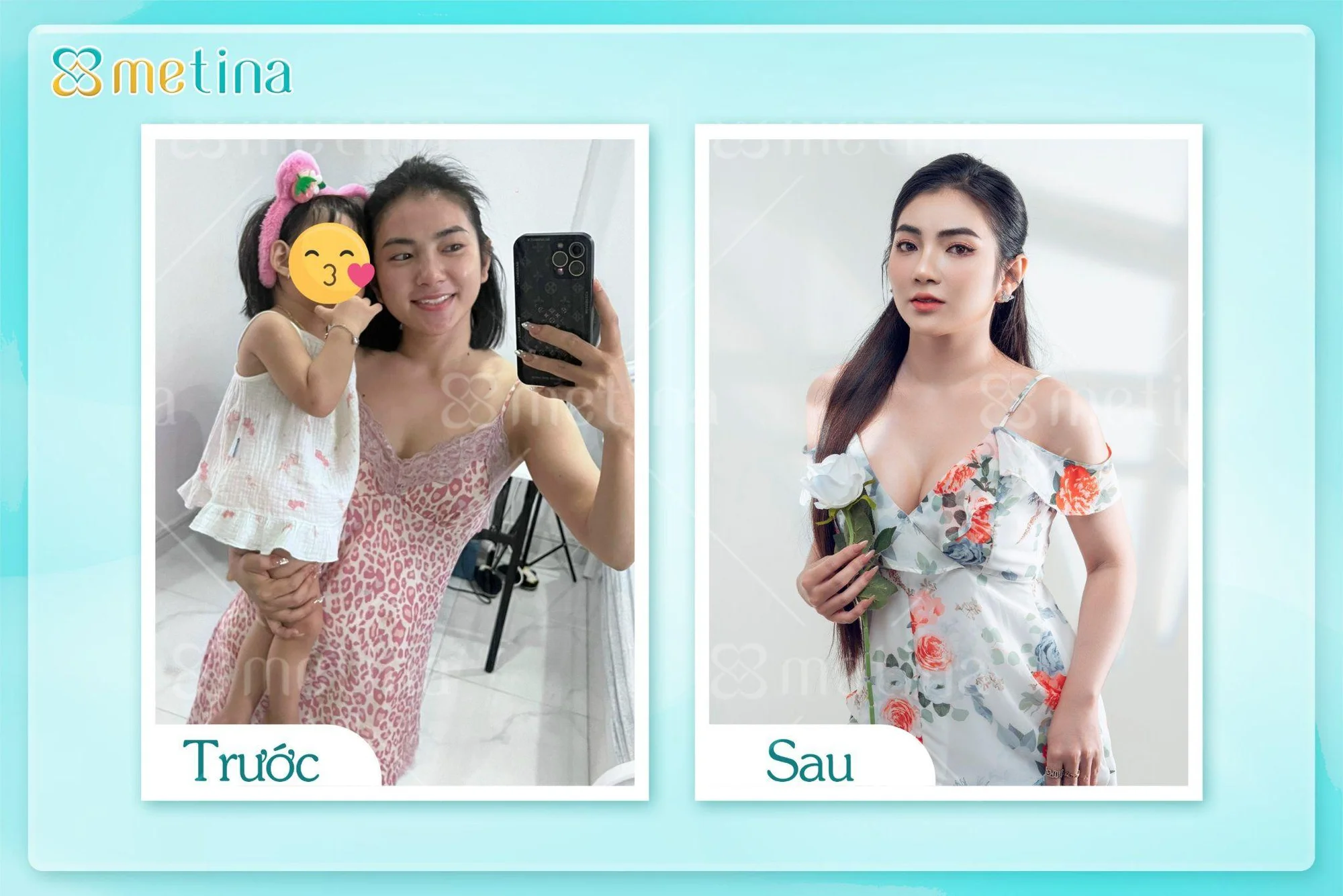 7 DÁNG NGỰC PHỔ BIẾN NHẤT - Dr. Châu Thanh Phong - Thẩm mỹ 3 vòng
