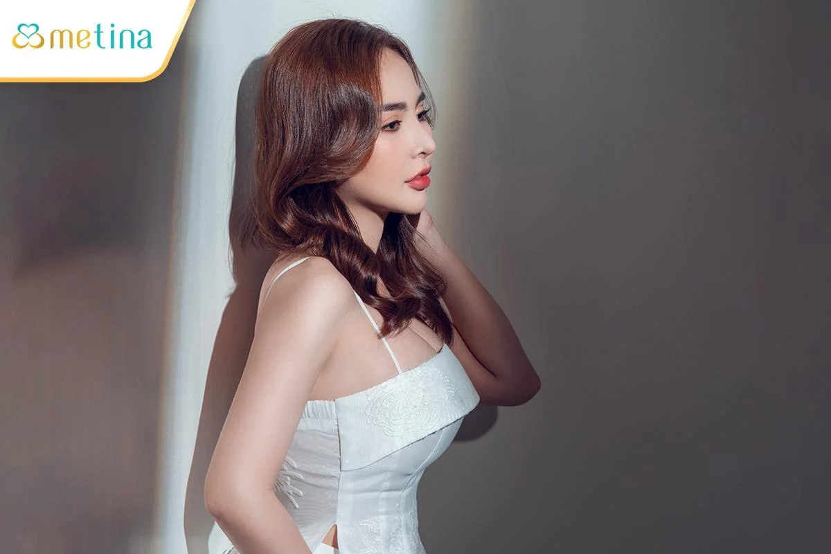 Thành quả sau 5 năm nâng ngực của chị N.T. do bác sĩ CKI. Châu Thanh Phong th... - Dr. Châu Thanh Phong - Thẩm mỹ 3 vòng