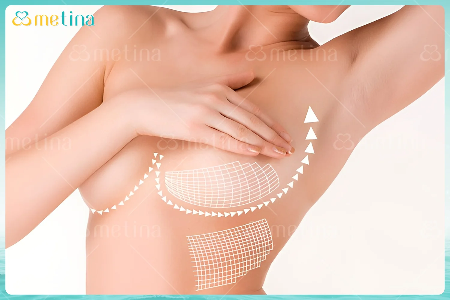 Treo sa trễ là gì? - Dr. Châu Thanh Phong - Thẩm mỹ 3 vòng