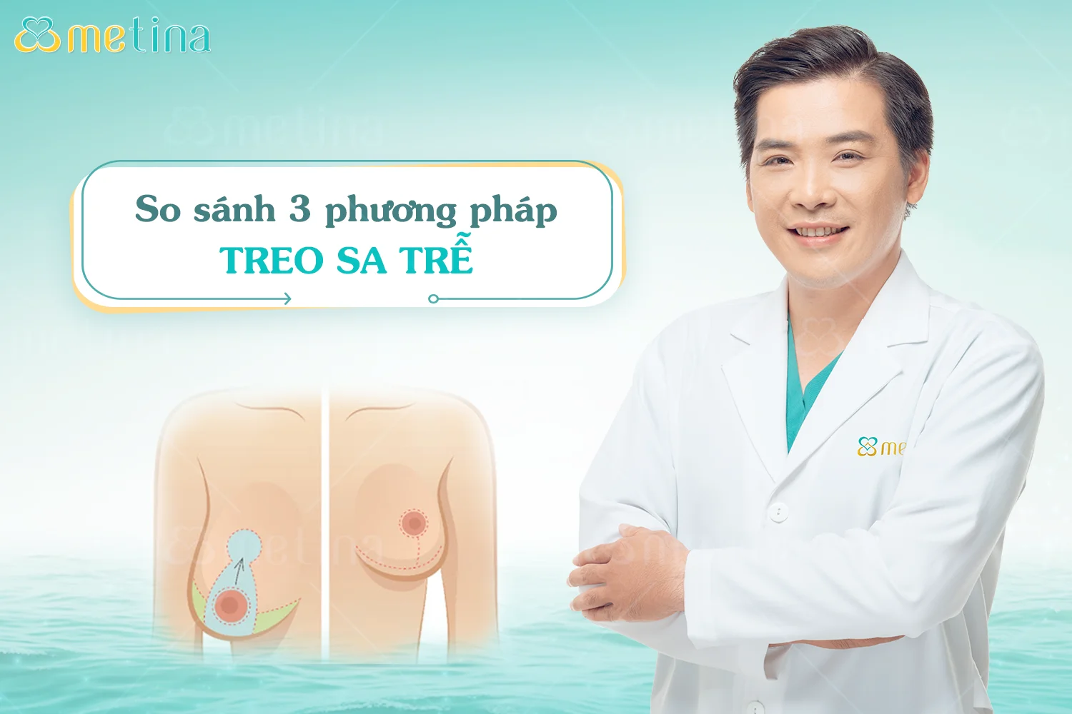 Treo sa trễ là gì? - Dr. Châu Thanh Phong - Thẩm mỹ 3 vòng